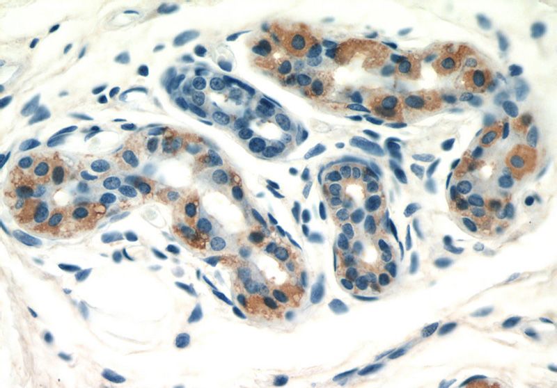 Immunohistochemical of paraffin-embedded human skin using Catalog No:110928(GDI2 antibody) at dilution of 1:50 (under 40x lens)