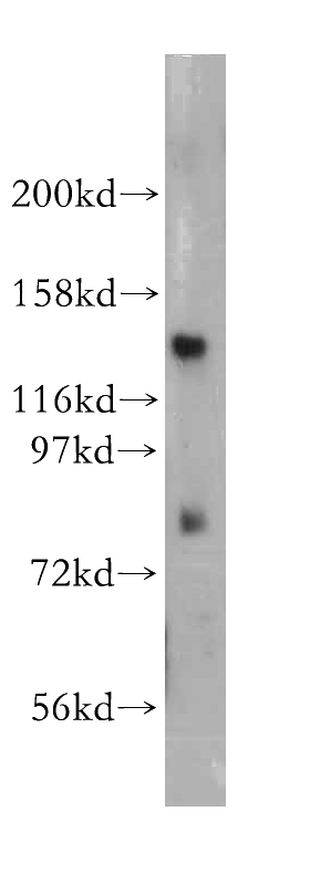 HL-60 cells were subjected to SDS PAGE followed by western blot with Catalog No:110343(EPB41 antibody) at dilution of 1:100