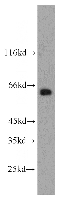 A431 cells were subjected to SDS PAGE followed by western blot with Catalog No:112307(LCP1 antibody) at dilution of 1:3000