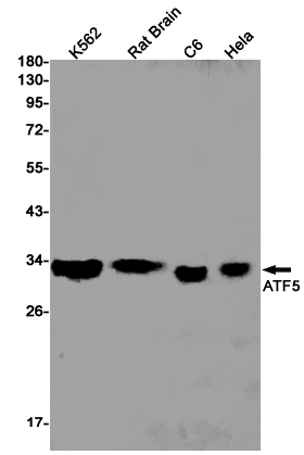 Western blot detection of ATF5 in K562,Rat Brain,C6,Hela cell lysates using ATF5 Rabbit pAb(1:1000 diluted).Predicted band size:31kDa.Observed band size:31kDa.