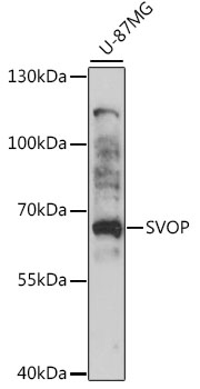 Western blot - SVOP Polyclonal Antibody 