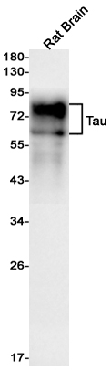 Western blot detection of Tau in Rat Brain lysates using Tau Rabbit mAb(1:1000 diluted).Predicted band size:79kDa.Observed band size:50-80kDa.