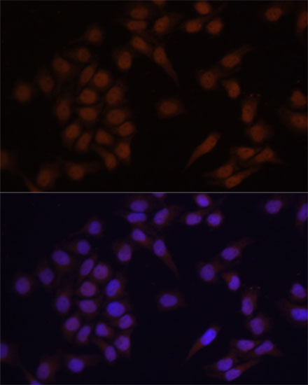 Immunofluorescence - PRDM14 Polyclonal Antibody 