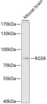 Western blot - RGS9 Polyclonal Antibody 
