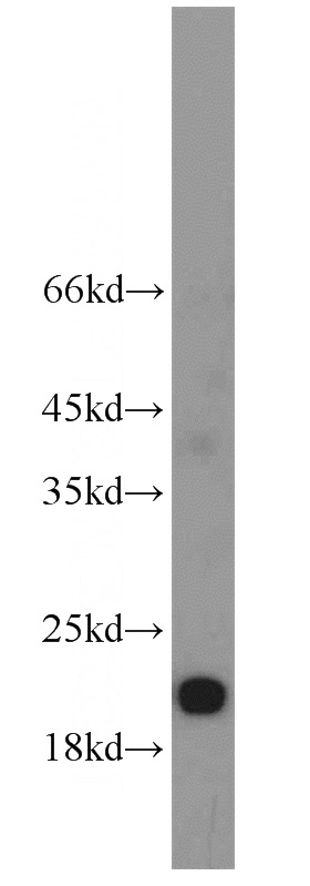MCF7 cells were subjected to SDS PAGE followed by western blot with Catalog No:114311(PTP4A1 antibody) at dilution of 1:800