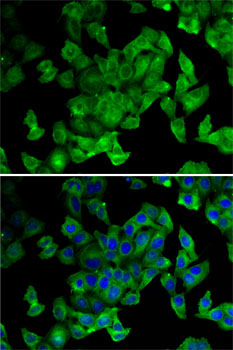 Immunofluorescence - PPL Polyclonal Antibody 