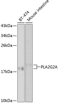 Western blot - PLA2G2A Polyclonal Antibody 