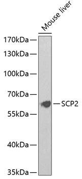 Western blot - SCP2 Polyclonal Antibody 