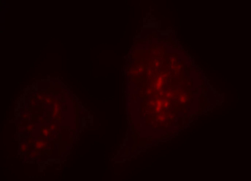Immunofluorescent analysis of Hela cells, using INTS8 antibody Catalog No:111810 at 1:25 dilution and Rhodamine-labeled goat anti-rabbit IgG (red).