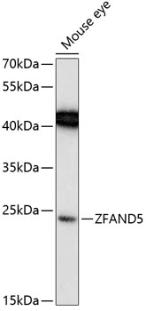 Western blot - ZFAND5 Polyclonal Antibody 