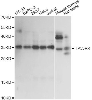 Western blot - TP53RK Polyclonal Antibody 