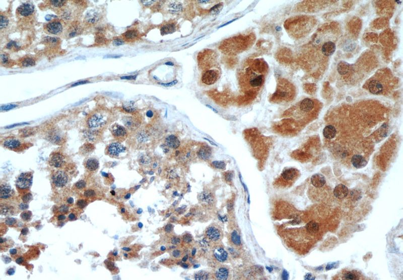 Immunohistochemical of paraffin-embedded human testis using Catalog No:116847(WBP2 antibody) at dilution of 1:50 (under 40x lens)
