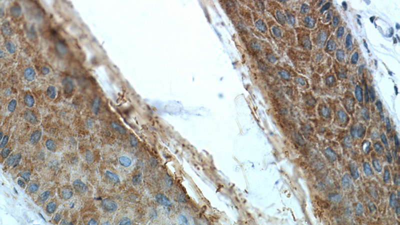 Immunohistochemical of paraffin-embedded human skin using Catalog No:112131(KRT34 antibody) at dilution of 1:50 (under 40x lens)