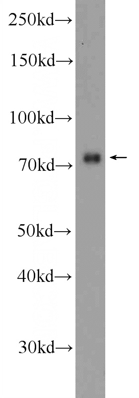 SH-SY5Y cells were subjected to SDS PAGE followed by western blot with Catalog No:117003(ZNF549 Antibody) at dilution of 1:600