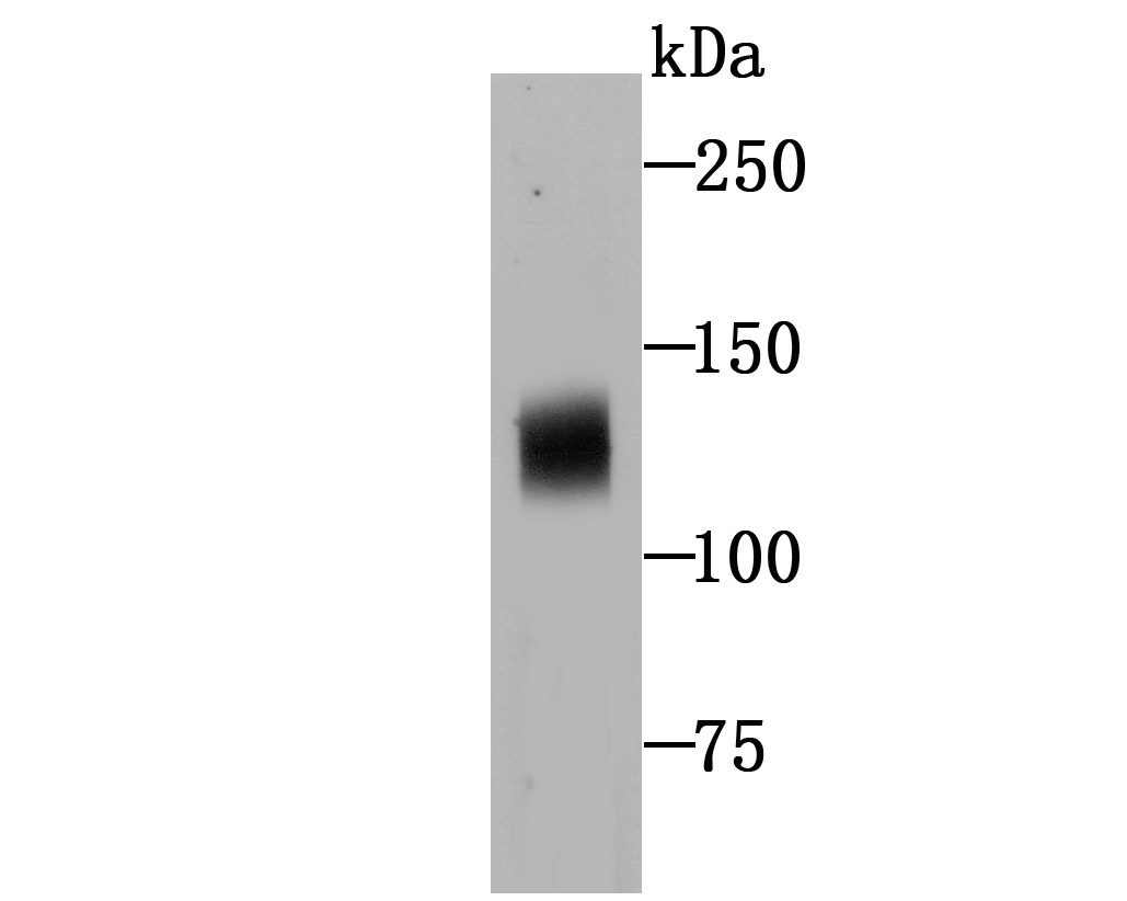Fig1: Western blot analysis of NLRC3 on human thymus tissue lysates using anti-NLRC3 antibody at 1/500 dilution.