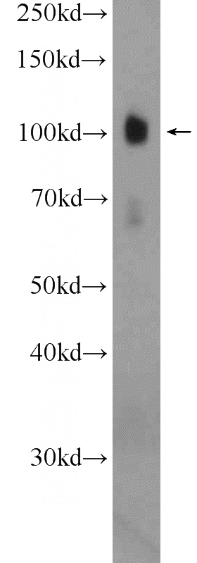 mouse brain tissue were subjected to SDS PAGE followed by western blot with Catalog No:110344(EPB41L1 Antibody) at dilution of 1:600