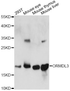 Western blot - ORMDL3 Polyclonal Antibody 