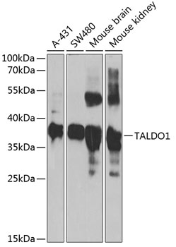 Western blot - TALDO1 Polyclonal Antibody 