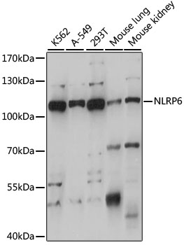 Western blot - NLRP6 Polyclonal Antibody 