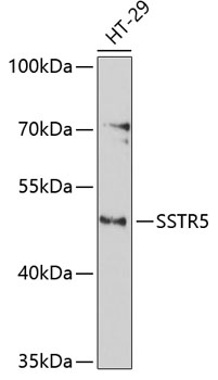 Western blot - SSTR5 Polyclonal Antibody 