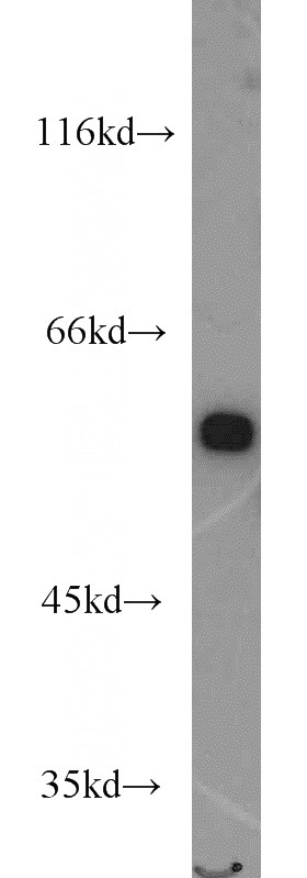 Jurkat cells were subjected to SDS PAGE followed by western blot with Catalog No:113816(PHGDH antibody) at dilution of 1:1200
