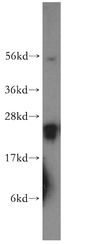 human brain tissue were subjected to SDS PAGE followed by western blot with Catalog No:114443(RAB3C-specific antibody) at dilution of 1:300