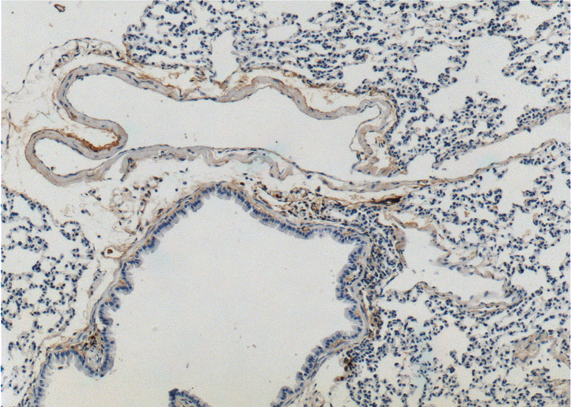 Immunohistochemistry of paraffin-embedded mouse lung tissue slide using Catalog No:110285(ELN Antibody) at dilution of 1:200 (under 10x lens).