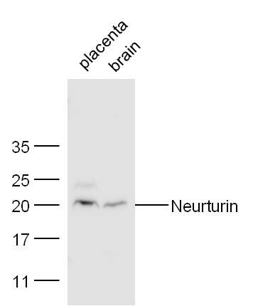 Fig1: Sample:; Placenta(Mouse)lysate at 30 ug;; Brain(Mouse) lysate at 30 ug;; Primary: Anti- Neurturin at 1:300 dilution;; Secondary: HRP conjugated Goat-Anti-rabbit IgG(bs-0295G-HRP) at 1: 5000 dilution;; Predicted band size: 21 kD; Observed band size: 21 kD
