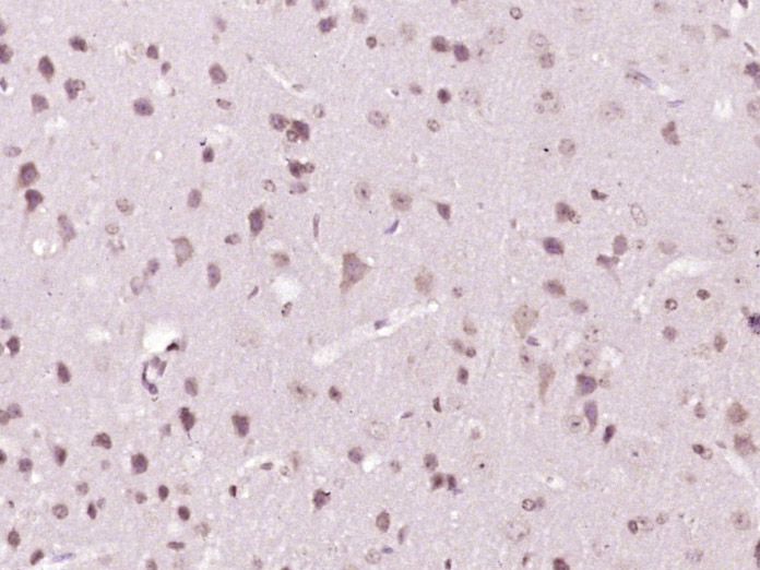 Fig3: Paraformaldehyde-fixed, paraffin embedded (mouse brain tissue); Antigen retrieval by boiling in sodium citrate buffer (pH6.0) for 15min; Block endogenous peroxidase by 3% hydrogen peroxide for 20 minutes; Blocking buffer (normal goat serum) at 37℃ for 30min; Antibody incubation with (Afadin) Polyclonal Antibody, Unconjugated at 1:400 overnight at 4℃, followed by operating according to SP Kit(Rabbit) (sp-0023) instructionsand DAB staining.