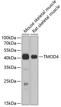 Western blot - TMOD4 Polyclonal Antibody 