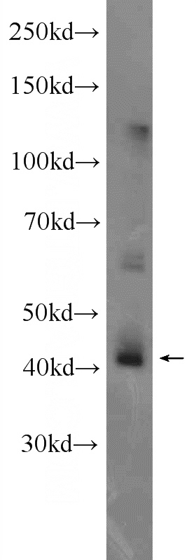 mouse testis tissue were subjected to SDS PAGE followed by western blot with Catalog No:109268(CEP170L Antibody) at dilution of 1:1000