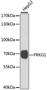Western blot - PRKG1 Polyclonal Antibody 