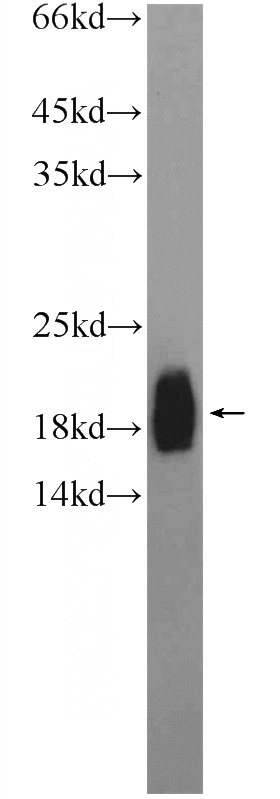 PC-3 cells were subjected to SDS PAGE followed by western blot with Catalog No:117030(ZNF747 Antibody) at dilution of 1:600