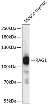 Western blot - RAG1 Polyclonal Antibody 