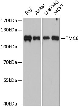 Western blot - TMC6 Polyclonal Antibody 