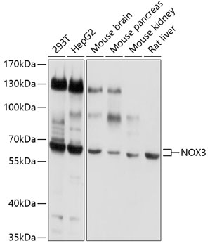 Western blot - NOX3 Polyclonal Antibody 