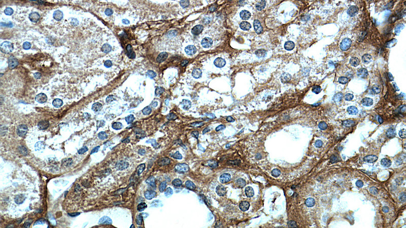 Immunohistochemical of paraffin-embedded human kidney using Catalog No:110656(FGB antibody) at dilution of 1:50 (under 40x lens)