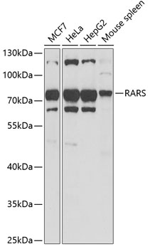 Western blot - RARS Polyclonal Antibody 