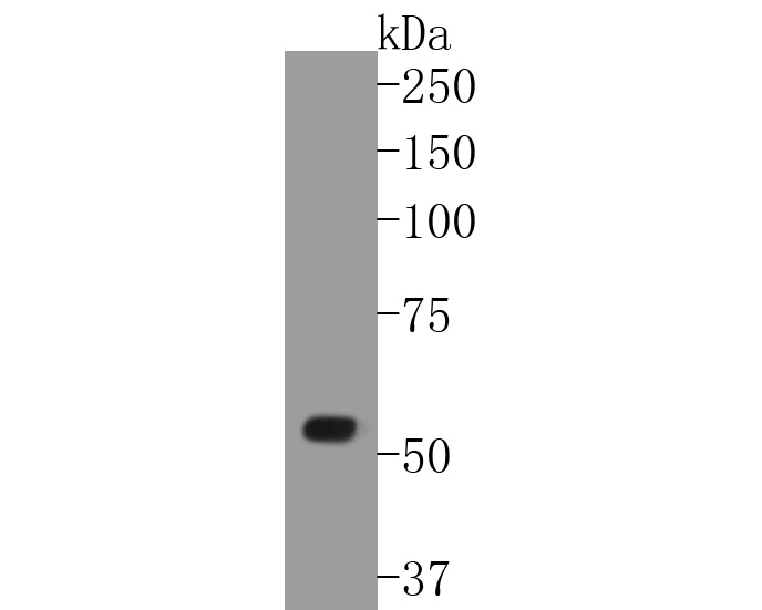 Fig1:; Western blot analysis of WASF2 on human placenta tissue lysates. Proteins were transferred to a PVDF membrane and blocked with 5% BSA in PBS for 1 hour at room temperature. The primary antibody ( 1/500) was used in 5% BSA at room temperature for 2 hours. Goat Anti-Rabbit IgG - HRP Secondary Antibody (HA1001) at 1:5,000 dilution was used for 1 hour at room temperature.