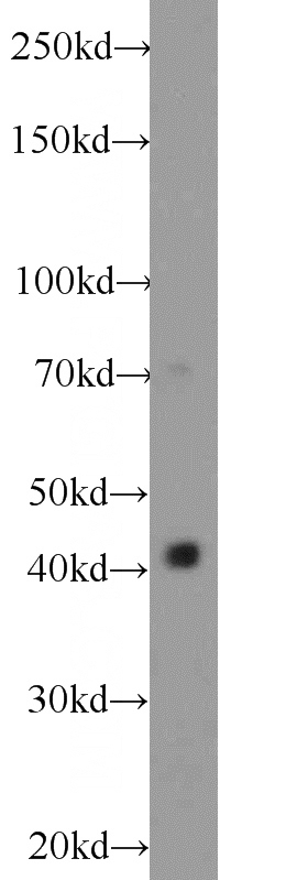 mouse brain tissue were subjected to SDS PAGE followed by western blot with Catalog No:113509(OSTM1 antibody) at dilution of 1:1000
