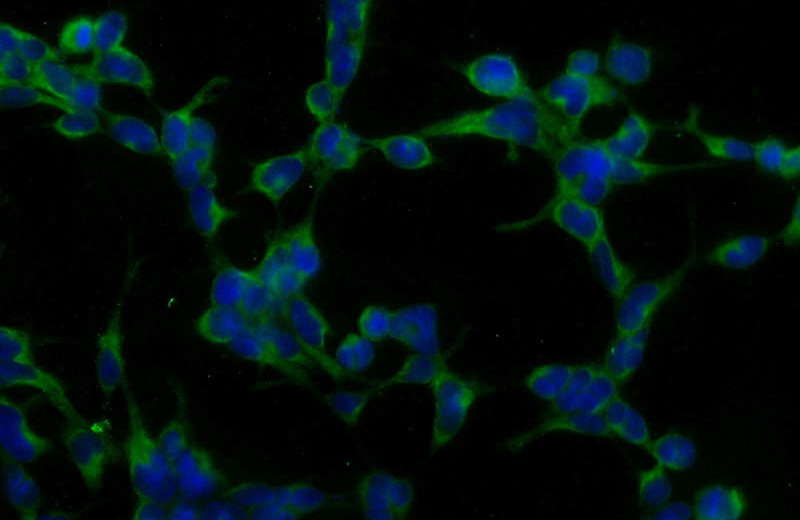 Immunofluorescent analysis of HEK-293 cells using Catalog No:115723(STK38 Antibody) at dilution of 1:50 and Alexa Fluor 488-congugated AffiniPure Goat Anti-Rabbit IgG(H+L)