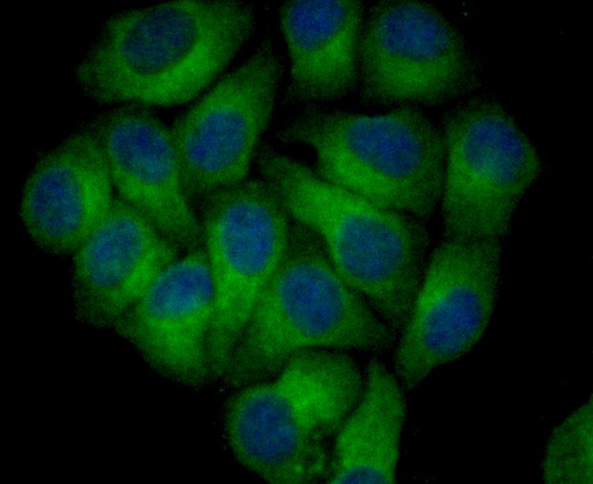 Fig4:; ICC staining of Nogo in HepG2 cells (green). Formalin fixed cells were permeabilized with 0.1% Triton X-100 in TBS for 10 minutes at room temperature and blocked with 10% negative goat serum for 15 minutes at room temperature. Cells were probed with the primary antibody ( 1/50) for 1 hour at room temperature, washed with PBS. Alexa Fluor®488 conjugate-Goat anti-Rabbit IgG was used as the secondary antibody at 1/1,000 dilution. The nuclear counter stain is DAPI (blue).