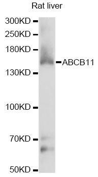 Western blot - ABCB11 Polyclonal Antibody 