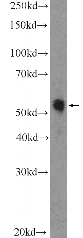 HepG2 cells were subjected to SDS PAGE followed by western blot with Catalog No:116400(TRMT61B Antibody) at dilution of 1:600