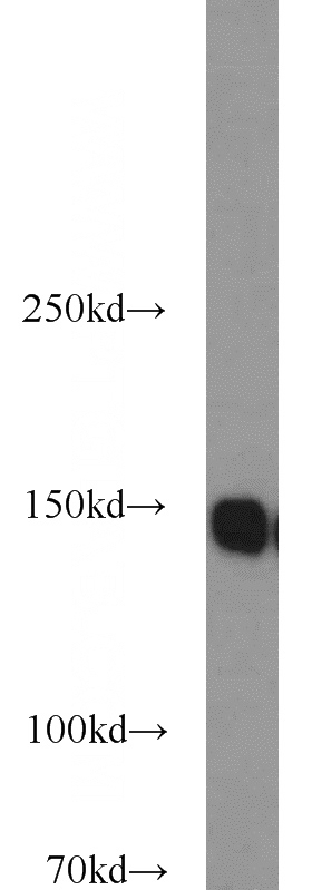 HeLa cells were subjected to SDS PAGE followed by western blot with Catalog No:107927(AKAP1 antibody) at dilution of 1:1000