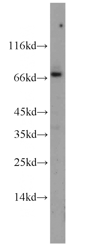 mouse brain tissue were subjected to SDS PAGE followed by western blot with Catalog No:109575(CRNN antibody) at dilution of 1:300