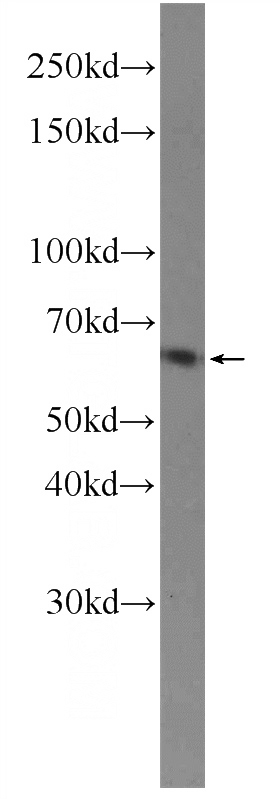 rat brain tissue were subjected to SDS PAGE followed by western blot with Catalog No:114202(PRKG1 Antibody) at dilution of 1:600