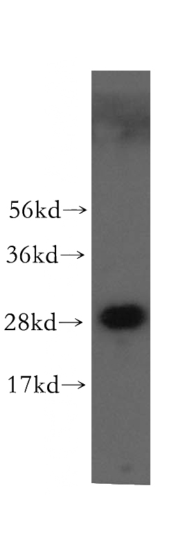 human brain tissue were subjected to SDS PAGE followed by western blot with Catalog No:116807(VTI1A antibody) at dilution of 1:500