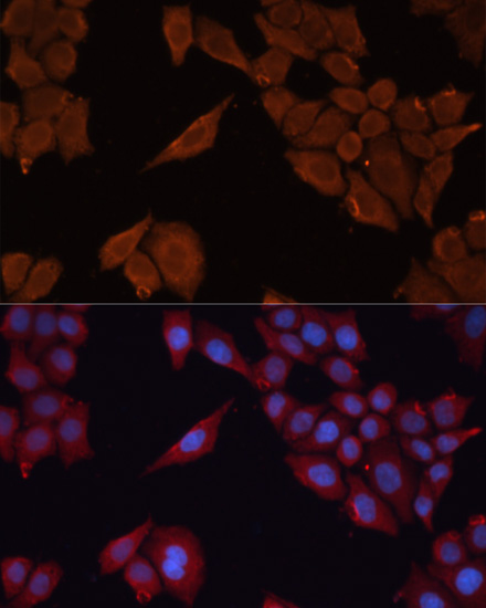 Immunofluorescence - SLC25A27 Polyclonal Antibody 