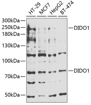 Western blot - DIDO1 Polyclonal Antibody 